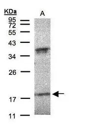 Anti-Interferon alpha 6 antibody [C1C3] used in Western Blot (WB). GTX108423