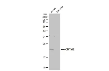 Anti-CMTM6 antibody [C1C3] used in Western Blot (WB). GTX108450