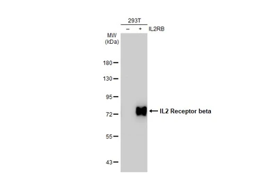 Anti-IL2 Receptor beta antibody [C3], C-term used in Western Blot (WB). GTX108495