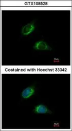 Anti-Noelin antibody [C3], C-term used in Immunocytochemistry/ Immunofluorescence (ICC/IF). GTX108528