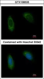 Anti-TRAM1 antibody [C2C3], C-term used in Immunocytochemistry/ Immunofluorescence (ICC/IF). GTX108535