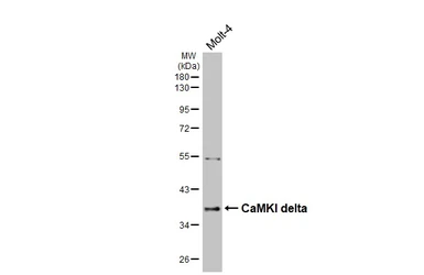 Anti-CaMKI delta antibody [N1C3] used in Western Blot (WB). GTX108565