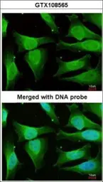 Anti-CaMKI delta antibody [N1C3] used in Immunocytochemistry/ Immunofluorescence (ICC/IF). GTX108565