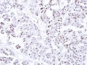 Anti-CaMKI delta antibody [N1C3] used in IHC (Paraffin sections) (IHC-P). GTX108565