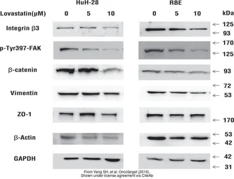Anti-ZO-1 antibody used in Western Blot (WB). GTX108592