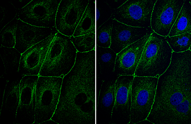 Anti-ZO-1 antibody used in Immunocytochemistry/ Immunofluorescence (ICC/IF). GTX108592