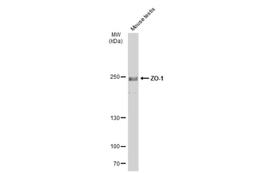 Anti-ZO-1 antibody used in Western Blot (WB). GTX108592