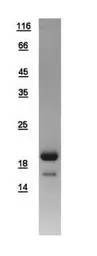 Human p18 INK4c protein, His tag. GTX108593-pro