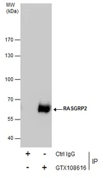 Anti-RASGRP2 antibody used in Immunoprecipitation (IP). GTX108616