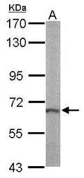 Anti-RASGRP2 antibody used in Western Blot (WB). GTX108616