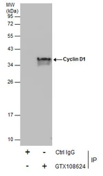 Anti-Cyclin D1 antibody [N1C3] used in Immunoprecipitation (IP). GTX108624