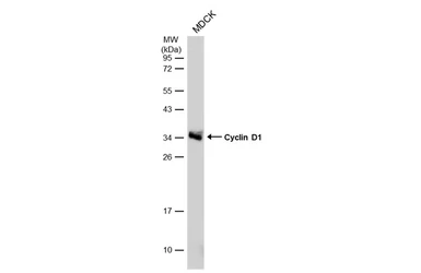 Anti-Cyclin D1 antibody [N1C3] used in Western Blot (WB). GTX108624