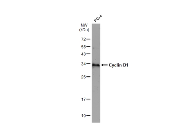 Anti-Cyclin D1 antibody [N1C3] used in Western Blot (WB). GTX108624