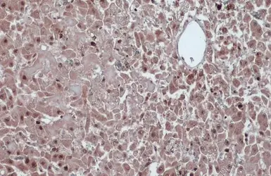 Anti-Cyclin D1 antibody [N1C3] used in IHC (Paraffin sections) (IHC-P). GTX108624