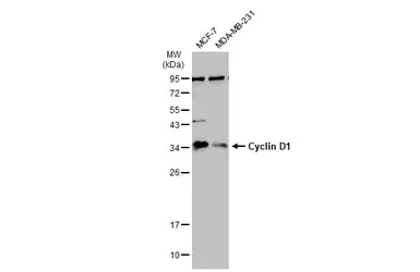 Anti-Cyclin D1 antibody [N1C3] used in Western Blot (WB). GTX108624