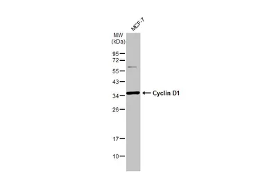 Anti-Cyclin D1 antibody [N1C3] used in Western Blot (WB). GTX108624