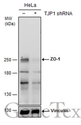 Anti-ZO-1 antibody [N2C1], Internal used in Western Blot (WB). GTX108627