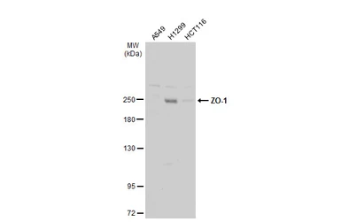 Anti-ZO-1 antibody [N2C1], Internal used in Western Blot (WB). GTX108627