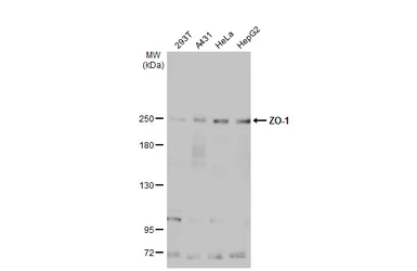 Anti-ZO-1 antibody [N2C1], Internal used in Western Blot (WB). GTX108627