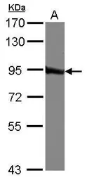 Anti-QARS antibody [N3C2], Internal used in Western Blot (WB). GTX108713