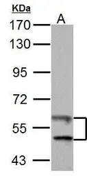 Anti-TrxR1 antibody [N3C2], Internal used in Western Blot (WB). GTX108727