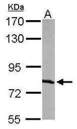 Anti-RPA70 antibody [C1C3] used in Western Blot (WB). GTX108749