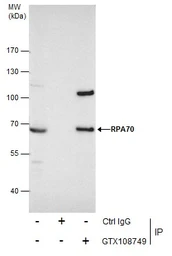 Anti-RPA70 antibody [C1C3] used in Immunoprecipitation (IP). GTX108749