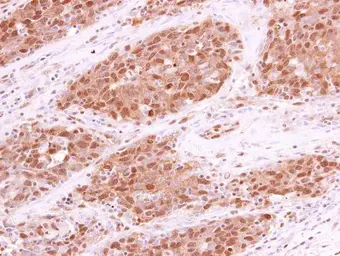 Anti-RPA70 antibody [C1C3] used in IHC (Paraffin sections) (IHC-P). GTX108749
