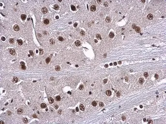 Anti-RPA70 antibody [C1C3] used in IHC (Paraffin sections) (IHC-P). GTX108749