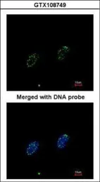 Anti-RPA70 antibody [C1C3] used in Immunocytochemistry/ Immunofluorescence (ICC/IF). GTX108749