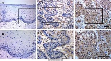Anti-TEAD4 antibody used in IHC (Paraffin sections) (IHC-P). GTX108750