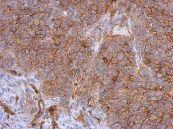 Anti-CD146 antibody [C1C3] used in IHC (Paraffin sections) (IHC-P). GTX108777