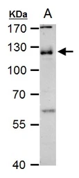 Anti-CD146 antibody [C1C3] used in Western Blot (WB). GTX108777