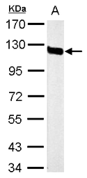 Anti-CD146 antibody [C1C3] used in Western Blot (WB). GTX108777