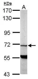 Anti-PDE9A antibody [N1N3] used in Western Blot (WB). GTX108786