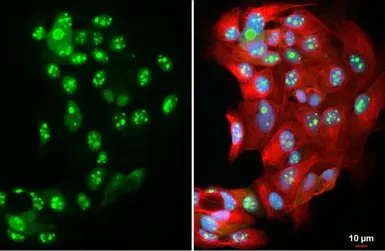 Anti-DNA ligase IV antibody used in Immunocytochemistry/ Immunofluorescence (ICC/IF). GTX108820