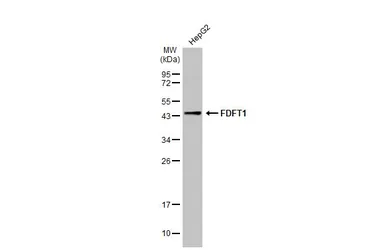 Anti-FDFT1 antibody [N1C3] used in Western Blot (WB). GTX108885