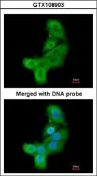 Anti-LIM kinase 2 antibody used in Immunocytochemistry/ Immunofluorescence (ICC/IF). GTX108903
