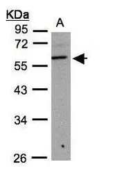 Anti-B3GNT3 antibody used in Western Blot (WB). GTX108928