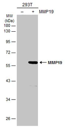 Anti-MMP19 antibody used in Western Blot (WB). GTX108931
