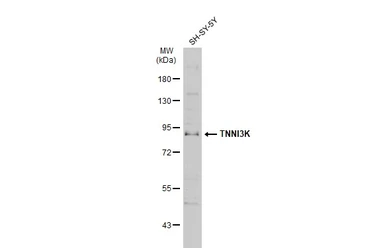 Anti-TNNI3K antibody [N2C1], Internal used in Western Blot (WB). GTX108944