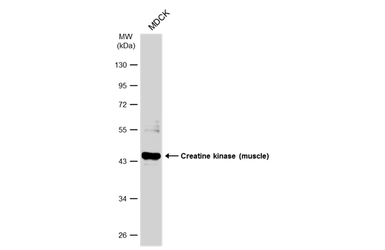 Anti-Creatine kinase (muscle) antibody [N2C3] used in Western Blot (WB). GTX108969