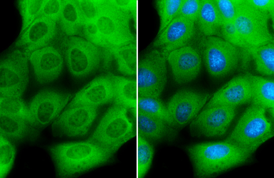 Anti-Creatine kinase (muscle) antibody [N2C3] used in Immunocytochemistry/ Immunofluorescence (ICC/IF). GTX108969
