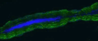 Anti-Creatine kinase (muscle) antibody [N2C3] used in Immunohistochemistry (IHC). GTX108969