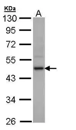 Anti-Creatine kinase (muscle) antibody [N2C3] used in Western Blot (WB). GTX108969