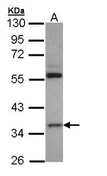 Anti-HMGCL antibody used in Western Blot (WB). GTX109096