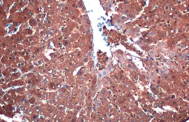 Anti-L-FABP antibody [N1C3] used in IHC (Paraffin sections) (IHC-P). GTX109142
