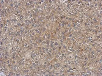 Anti-4E-BP1 antibody [N1C3] used in IHC (Paraffin sections) (IHC-P). GTX109162