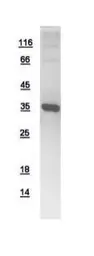 Human LHX8 protein, His tag. GTX109165-pro