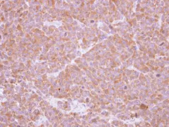 Anti-SBDS antibody [N1C3] used in IHC (Paraffin sections) (IHC-P). GTX109168